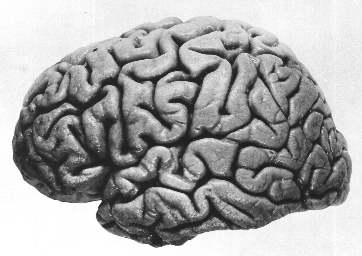 While a laptop can do a few billion operations in a second, the brain can do approximately one billion billion (1000000000000000000) operations per second. But it's used for things such as image recognition in the brain. That's why the laptop is faster in math calculations.
