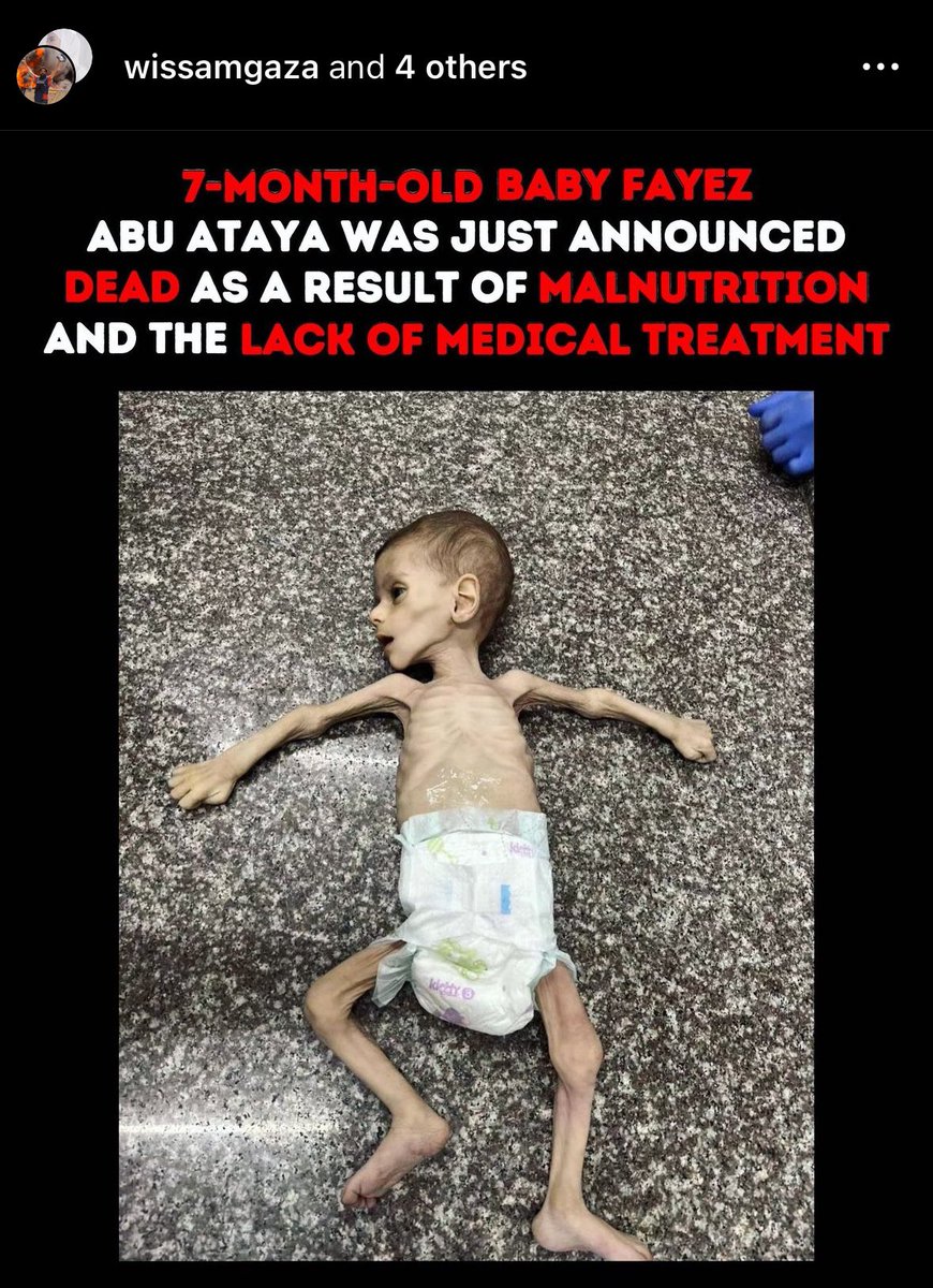 doryfan1's tweet photo. @SecBlinken Do you stand with this baby? You starved him to death! I hope you pay for your crimes against humanity. https://t.co/BGdfuqfDvV