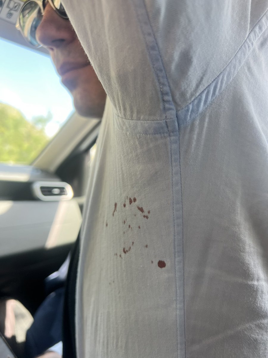 riccardomagi's tweet photo. Che sarà mai? Diranno che è solo un graffietto, due gocce di sangue. Il punto è che se questo accade ad un parlamentare sotto alle telecamere della stampa immaginate cosa potrà succedere ai poveri cristi che arriveranno qui a telecamere spente. https://t.co/AcT3p2jKeY