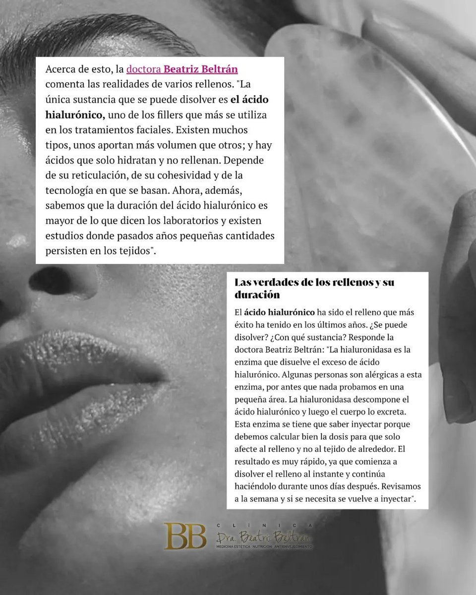 DraBeaBeltran's tweet photo. Es un placer participar como 𝗲𝘅𝗽𝗲𝗿𝘁𝗼𝘀 en @elmundoes @yo_dona en este artículo de Marta Sotillos. La Doctora Beatriz Beltrán ofrece sus conocimientos y experiencia para resolver las dudas sobre el ácido hialurónico ✨️

https://t.co/2RcU2SvAot https://t.co/MrMIFossUh
