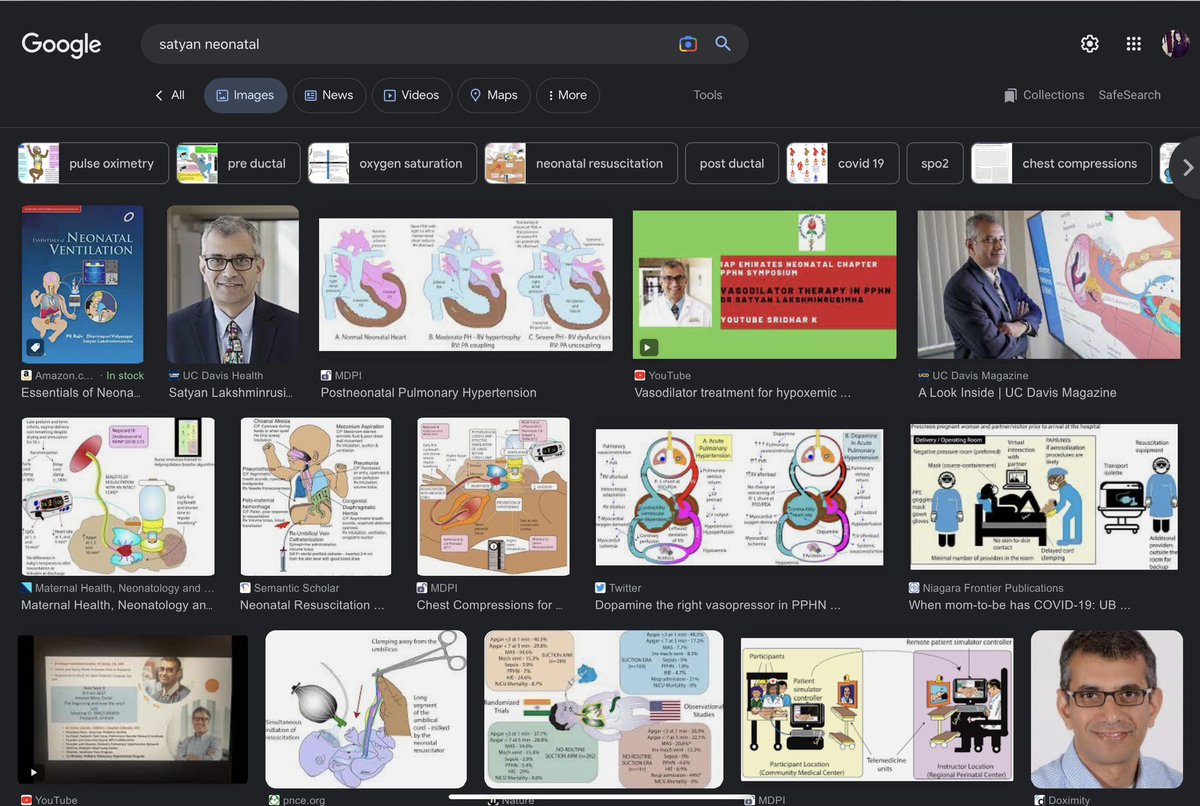 <a href="/neosatyan/">Satyan</a> is:
- educator extraordinaire
- 2023 <a href="/AmerAcadPeds/">American Academy of Pediatrics</a> Education awardee
- international authority on neonatal lung physiology &amp; 
- mastermind of #NeoGraphics 

#NeoGrandRounds 
#OneNotToMiss