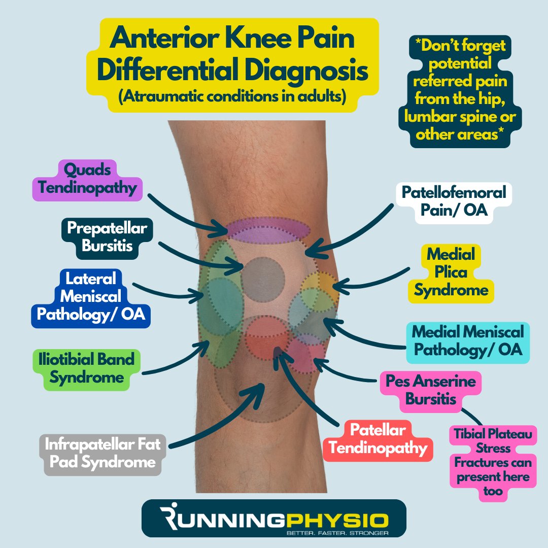 tomgoom's tweet photo. Anterior knee pain differential diagnosis
(Note pain location is approximate and may vary!) https://t.co/6DjqolwuRi