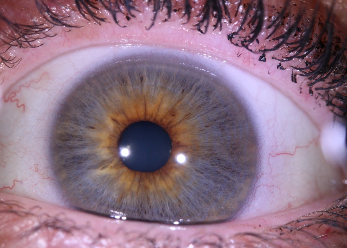 irislabltd's tweet photo. The importance of taking iris photos correctly cannot be overstated. Learn how to perfect your technique with IrisLab. https://t.co/4R48K6Sq2f

#IrisPhotography
#PerfectIrisTechnique
#IrisHealthMatters https://t.co/pg1ahdyLde