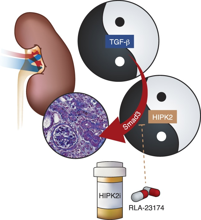 Kidney scarring or fibrosis occurs as a consequence of all CKD, but there is no specific treatment for kidney fibrosis. This article describes recent progress behind the discovery and development of a new potential therapy for kidney fibrosis bit.ly/JASN0327