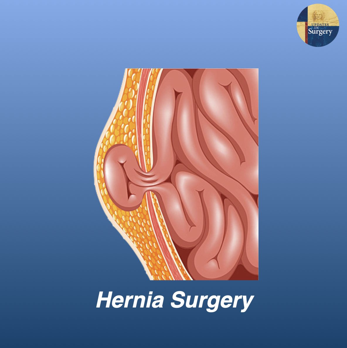 Updates in Surgery tweet media