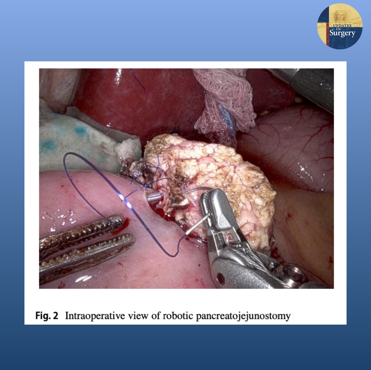 Updates in Surgery tweet media