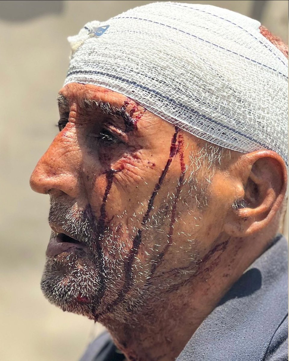 PalestinaVence's tweet photo. #Gaza 💔 https://t.co/AIQ9ZFBoj4