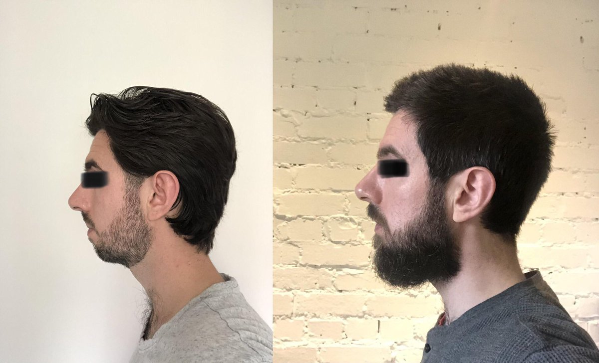 BasedBeardFish's tweet photo. So much higher
#BEARDFISH https://t.co/0nT0DInQPQ