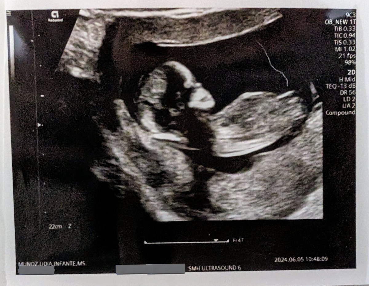 Lidia Infante is on BlueSky tweet media