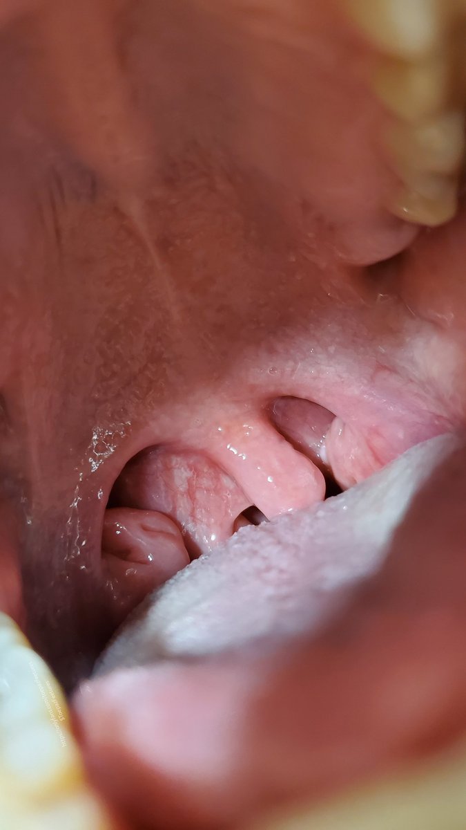 ToepazFeetures's tweet photo. "Oh, you're scared? Don't worry, I have a great panic room for you to visit."

Sizetwitter giantess uvula maw vore https://t.co/u9CL5XqKhu
