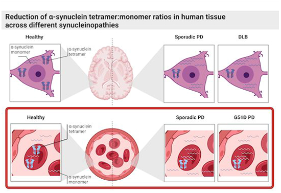 EMBO Mol. Medicine (@embomolmed) on Twitter photo Aggregation-resistant #AlphaSynuclein tetramers are reduced in the blood of #Parkinsons patients 🧠
By L. de Boni, T. Bartels & colleagues <a href="/UKDRI/">UK Dementia Research Institute</a>
🗞️doi.org/10.1038/s44321… Aggregation-resistant #AlphaSynuclein tetramers are reduced in the blood of #Parkinsons patients 🧠
By L. de Boni, T. Bartels & colleagues <a href="/UKDRI/">UK Dementia Research Institute</a>
🗞️doi.org/10.1038/s44321…