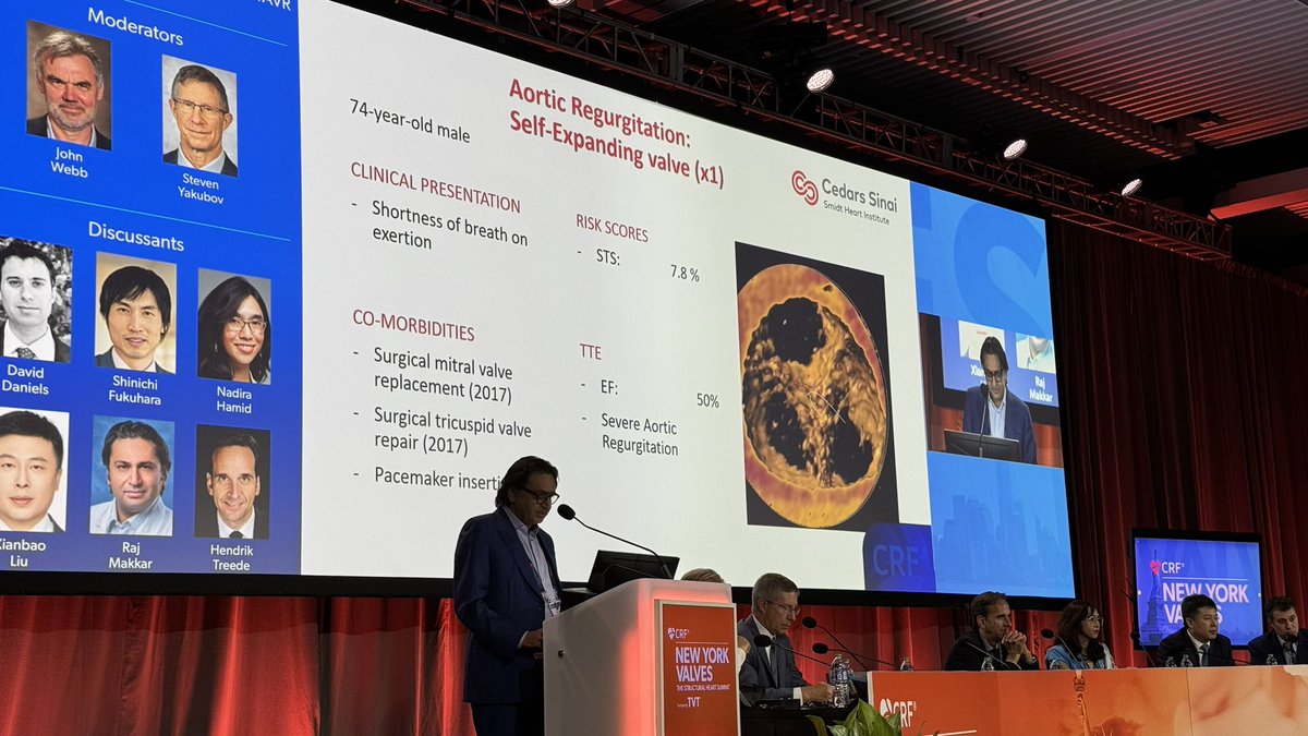 Daniel Hassan, MD (@danielzhassan) on Twitter photo Our dear mentor Dr. <a href="/RajMakkarMD/">Raj Makkar</a> Presenting “ Is pure aortic regurgitation the next TAVR frontier ? “ Our dear mentor Dr. <a href="/RajMakkarMD/">Raj Makkar</a> Presenting “ Is pure aortic regurgitation the next TAVR frontier ? “