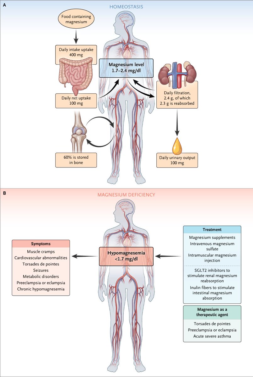 Hypomagnesemia is present in 3 to 10% of the general population, but its prevalence is increased among persons with type 2 diabetes and hospitalized patients, especially those in the intensive care unit. Learn more: nej.md/3V1RWQI