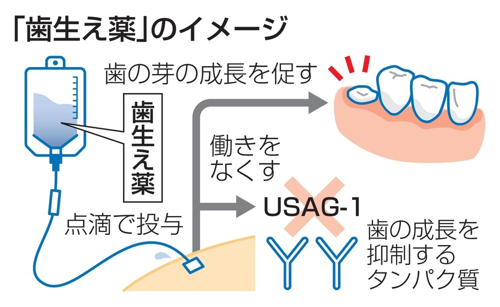 hitsuji_bright's tweet photo. 世界初、「歯を生やす薬」ついに実用化へ

通常、永久歯は抜けると2度と生えてこない。

これまでは入れ歯やインプラントで対応するしかなく、永久歯を生やすことはできなかった。

しかし、この常識が変ろうとしている。
京大ベンチャーの「トレジェムバイオファーマ」はついに歯を生やす薬を開発した。

マウスを使った研究により「USAG-1」というたんぱく質が歯の成長を阻害している事を発見。

そして、2021年にはこの「USAG-1」を無効化する抗体薬を開発。

動物実験では抗体薬投与で、永久歯が抜けた後も歯を生やすことに成功している。

今年の9月には成人男性30人を対象にした治験が始まり、2026年には歯が少ない子供50人を対象に治験が行われる。

歯を生やす薬は2030年には実用化される予定だ。

100歳でも綺麗な歯が20本以上ある。夢のような未来も近い。