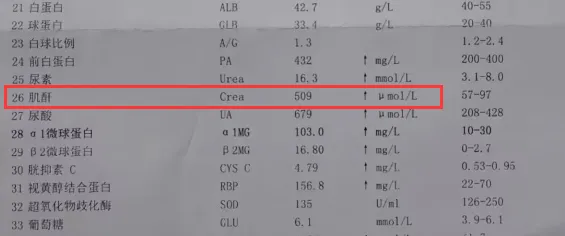 nancyzhangrui90's tweet photo. This is a 42-year-old patients with kidney disease from Shandong.After the combination of Chinese and Western medicine treatment,his creatinine dropped from 509 to 373.Symptoms of edema and other discomforts disappeared.#KidneyDisease #chinesemedicine #HighCreatinine #proteinuria https://t.co/DYZAMj2BUV