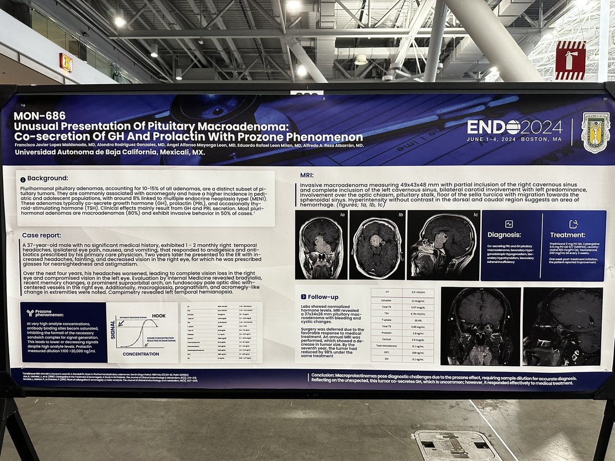 EduardoLeonMD's tweet photo. Had a great time at #ENDO2024.Had the opportunity to present a poster on a Pituitary Macroadenoma with Co-Secretion of GH and Prolactin
#match2025 #internalmedicine #pgy1 #img #match #medicine #casereport #endocrinology #intern #pituitary #match2024 #networking #USIMG #medtwitter https://t.co/GlS7j9Sxww