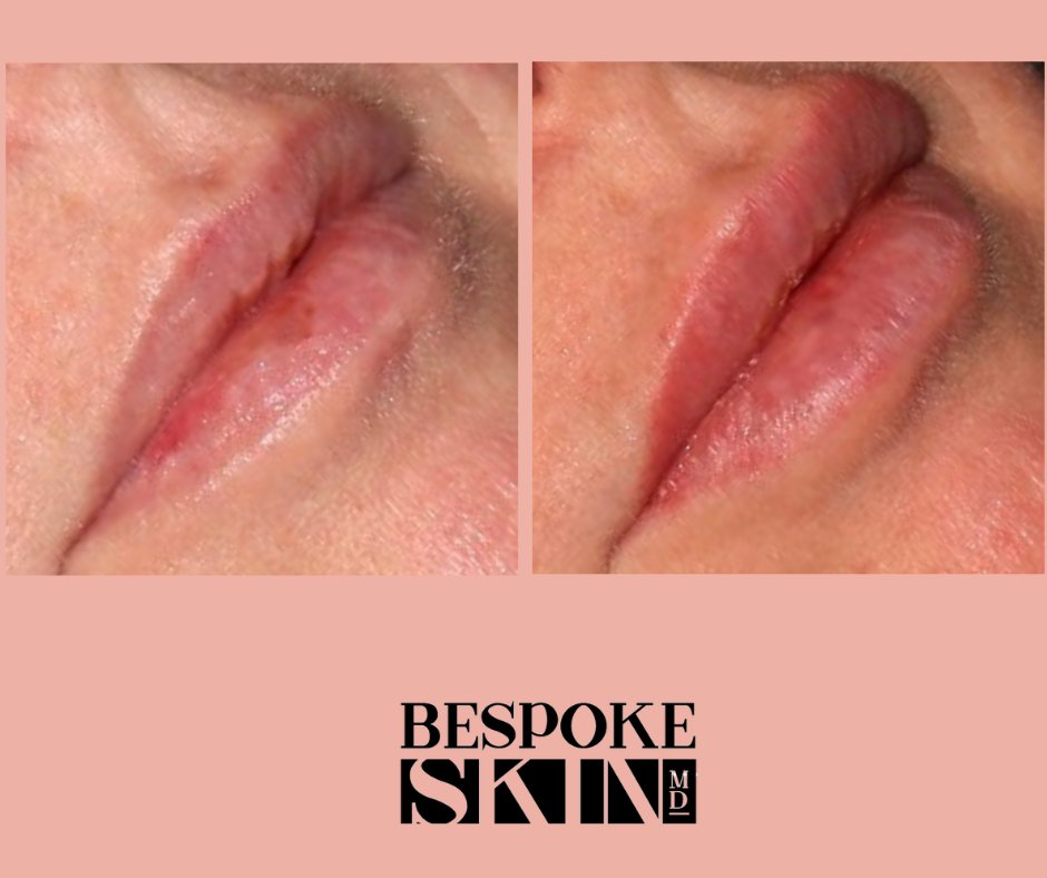Bespoke Skin MD tweet media