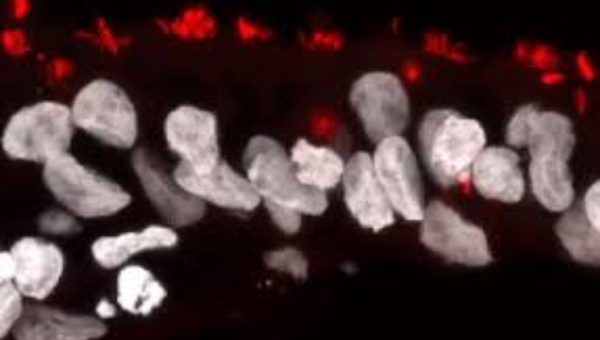 Queensland Brain Institute, UQ tweet media