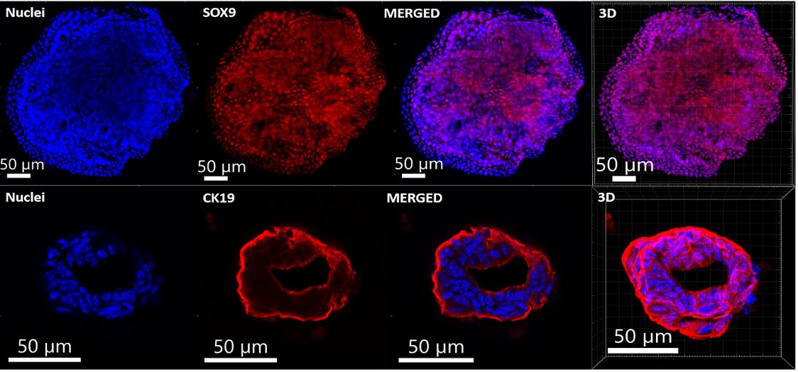 Investigators established 🎥 live-imaging #organoid/peripheral 🩸 blood mononuclear cells co-cultures, introducing OrganoIDNet, a deep-learning-based algorithm, capable of analyzing bright-field images of PDAC organoids acquired with live-cell imaging.

📖 bit.ly/3X8MEG3