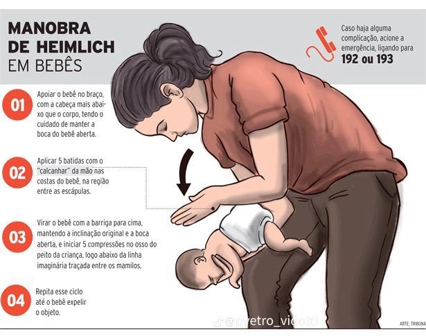 Passo a passo da manobra de Heimlich, muito importante saber mesmo não tendo bebê, você pode salvar o de alguém