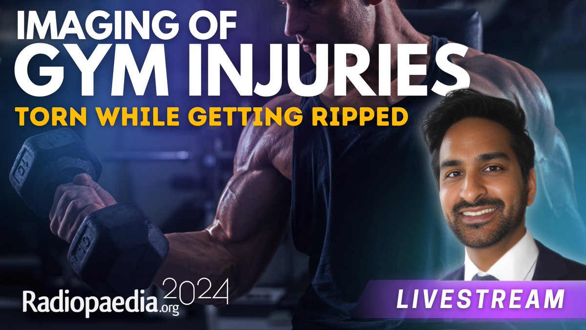 Andrew Dixon (@drandrewdixon) on Twitter photo Another free livestream in support of #Radiopaedia2024 coming up this Friday!
Watch <a href="/DocLasker/">Imran Lasker</a>’s entertaining lecture on the imaging of gym injuries. Hosted by <a href="/francisdeng/">Francis Deng, MD</a>.
🔔 youtube.com/radiologychann…
#foamrad #mskrad Another free livestream in support of #Radiopaedia2024 coming up this Friday!
Watch <a href="/DocLasker/">Imran Lasker</a>’s entertaining lecture on the imaging of gym injuries. Hosted by <a href="/francisdeng/">Francis Deng, MD</a>.
🔔 youtube.com/radiologychann…
#foamrad #mskrad