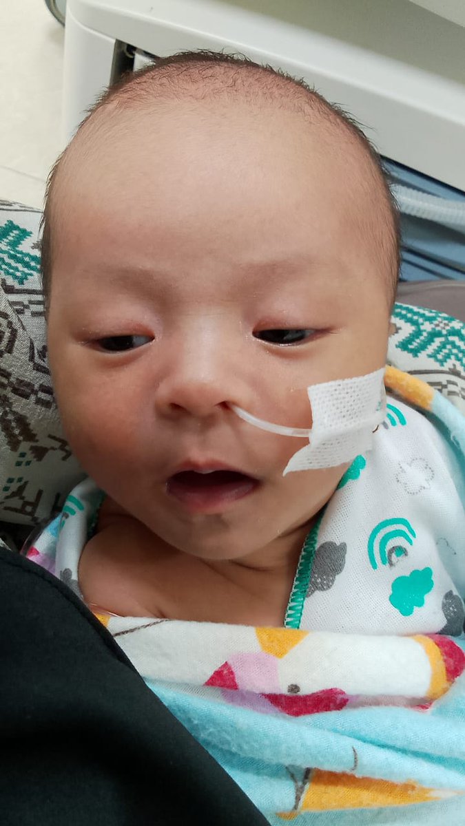 iwansaputrasap7's tweet photo. Bismillahirohmannirohim, assalamualaikum..mohon bantuan nya kpd bapak ibu, dengan kemurahan hati nya untuk menolong keponakan sakit yang sedang berjuang di rumah sakit.. Adek ini terindikasi teekena penyakit hisbrowww..mohon donasi nya, reg, arum retno sari bank Bpd jambi. https://t.co/xPl5mpjeFx