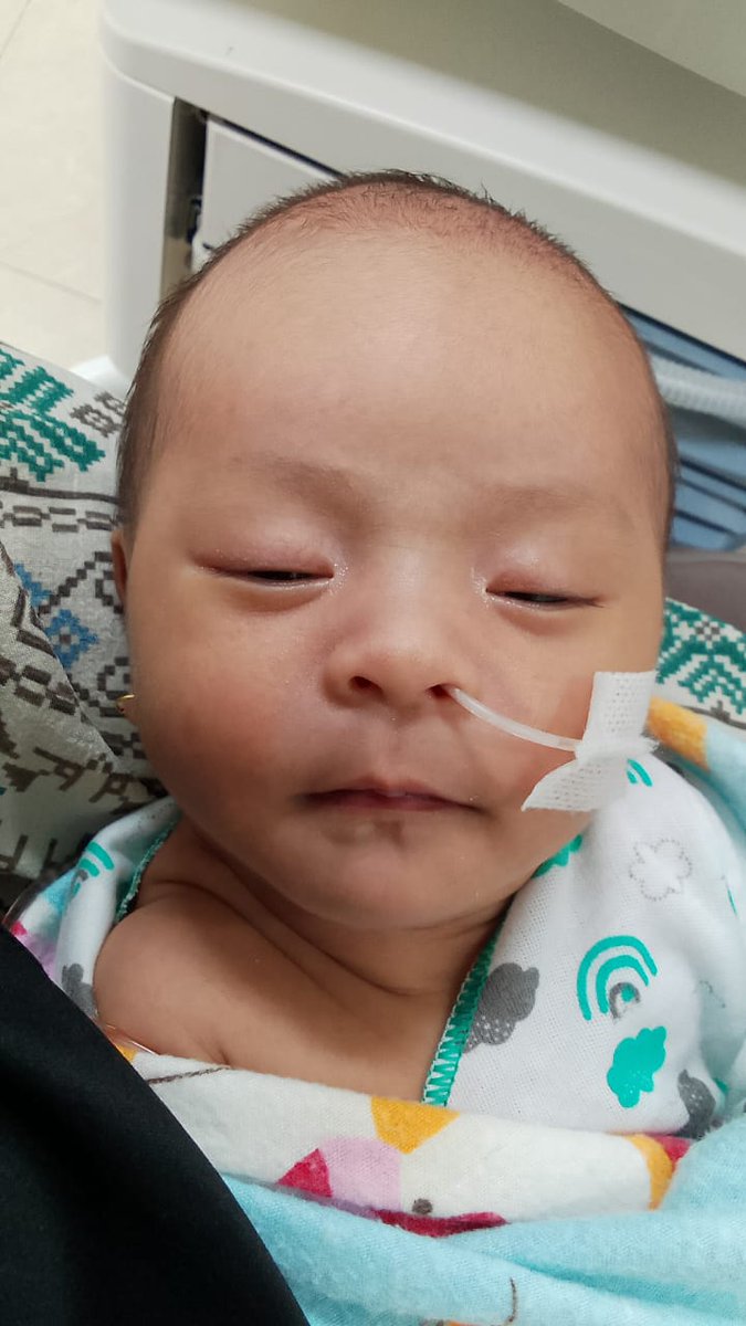 iwansaputrasap7's tweet photo. Bismillahirohmannirohim, assalamualaikum..mohon bantuan nya kpd bapak ibu, dengan kemurahan hati nya untuk menolong keponakan sakit yang sedang berjuang di rumah sakit.. Adek ini terindikasi teekena penyakit hisbrowww..mohon donasi nya, reg, arum retno sari bank Bpd jambi. https://t.co/xPl5mpjeFx