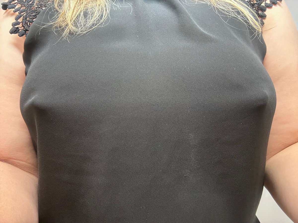 martin y ale tweet media