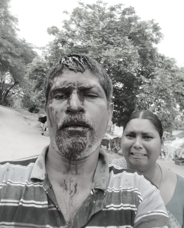 AadhanTelugu's tweet photo. తిరుపతి
చంద్రగిరి (మం) కల్ రోడ్డు పల్లి టీడీపీ ఏజెంట్ పై వైసీపీ అల్లరి మూకల దాడి... పోలింగ్ రోజున రిగ్గింగ్ ను అడ్డుకున్న ఏజెంట్ నందిపాటి త్యాగరాజు.. కక్షగట్టిన వైసీపీ మూకలు విచక్షణా రహితంగా దాడి..
#Attack #TDP #YCPTerroristsAttack #Latest_News #AadhanTelugu https://t.co/k6mrVniXkI