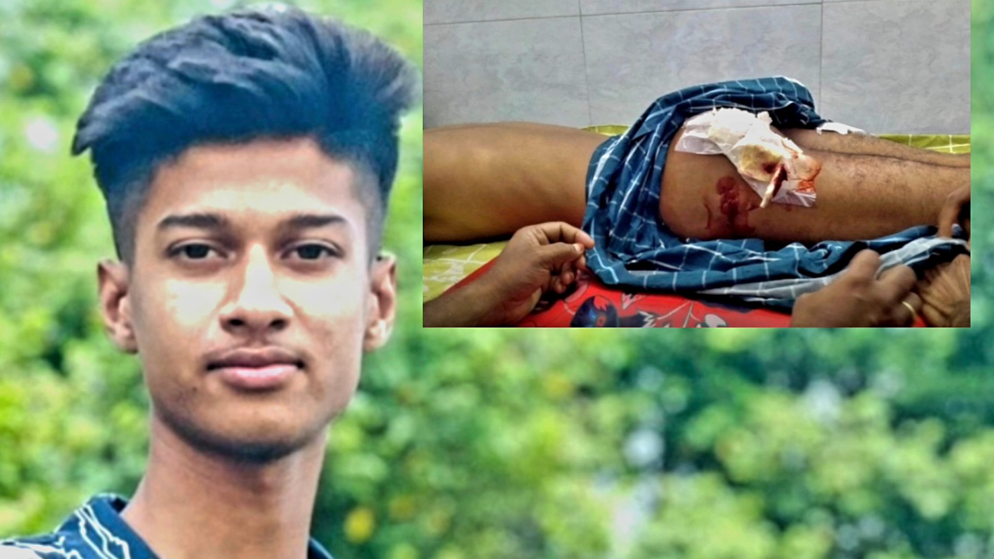 ঈশ্বরদীতে স্কুল ছাত্রীদের উত্ত্যক্ত করাকে কেন্দ্র করে বখাটেদের ছুরির আঘাতে শিক্ষার্থী আহত