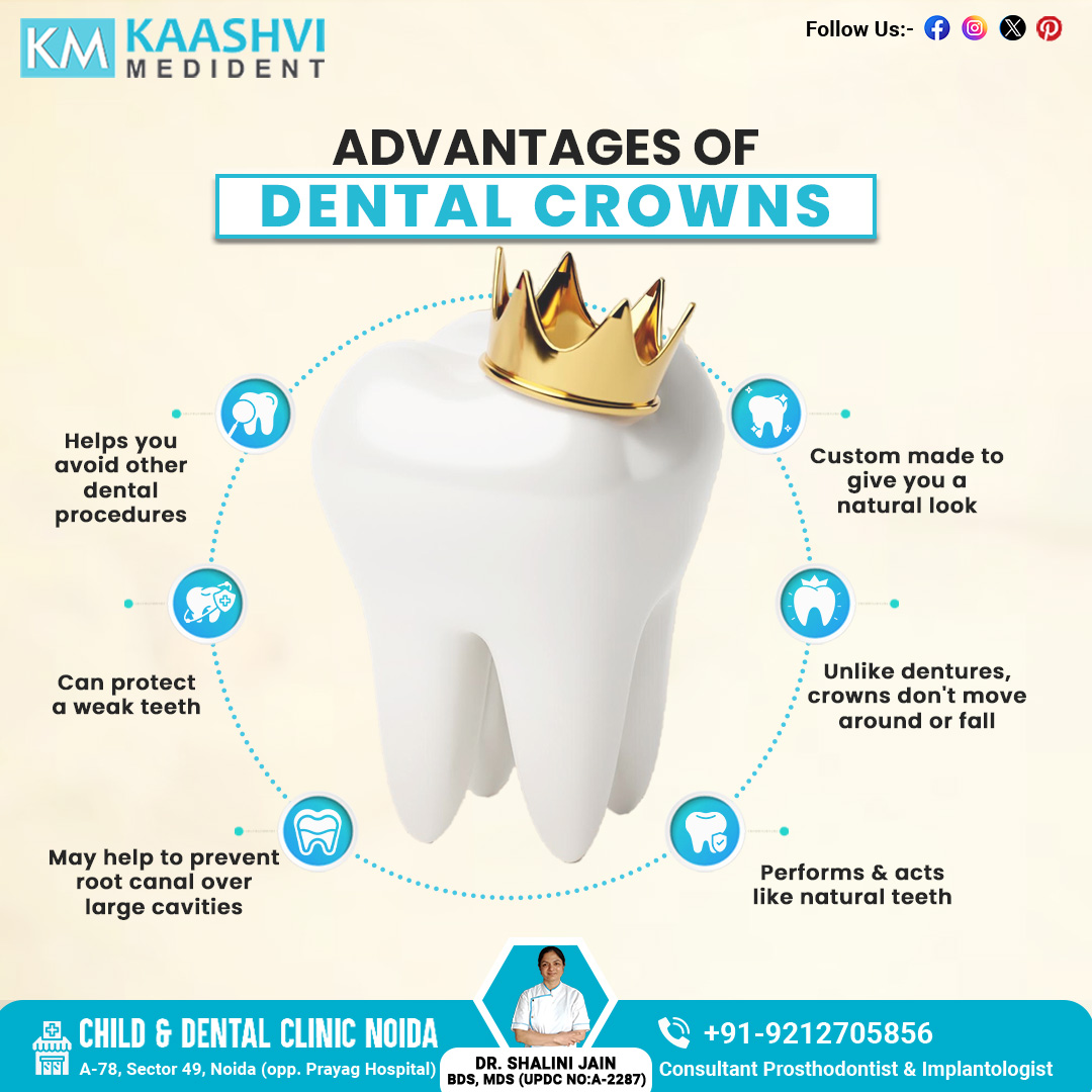 Smile brighter with dental crowns! 🌟 From preserving your natural smile to providing unmatched durability, crowns offer a world of benefits. Say goodbye to worries and hello to confidence! 😁✨ 

𝐖𝐞𝐛𝐬𝐢𝐭𝐞
bit.ly/KaashviMedident  
.
.
.
.
 #kaashvimedident #DrShaliniJain