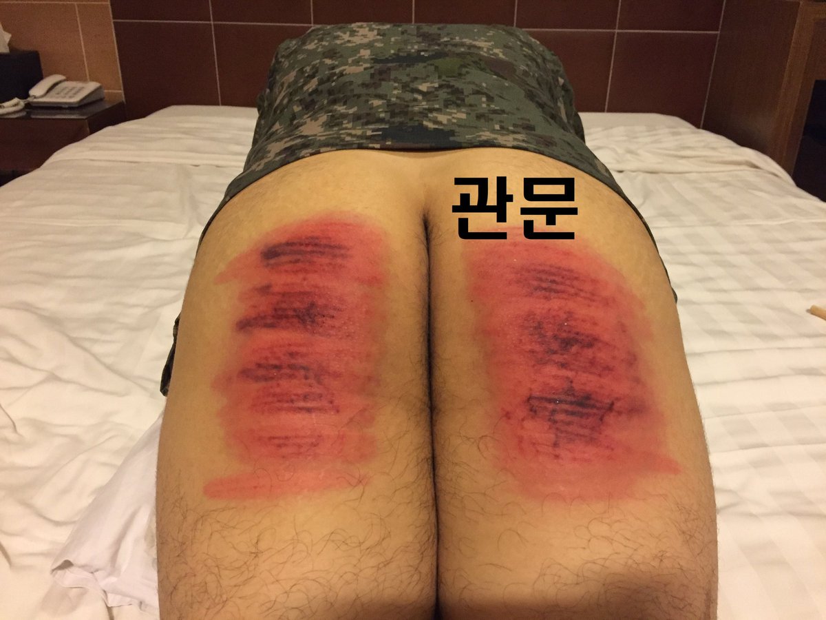 멜투멜#7
군바리들이 많이 찾네 ㅋㅋㅋ
전역하고 정신 좀 차리게 해달라고 찾아옴.
아크릴케인, 라탄케인으로 150대.