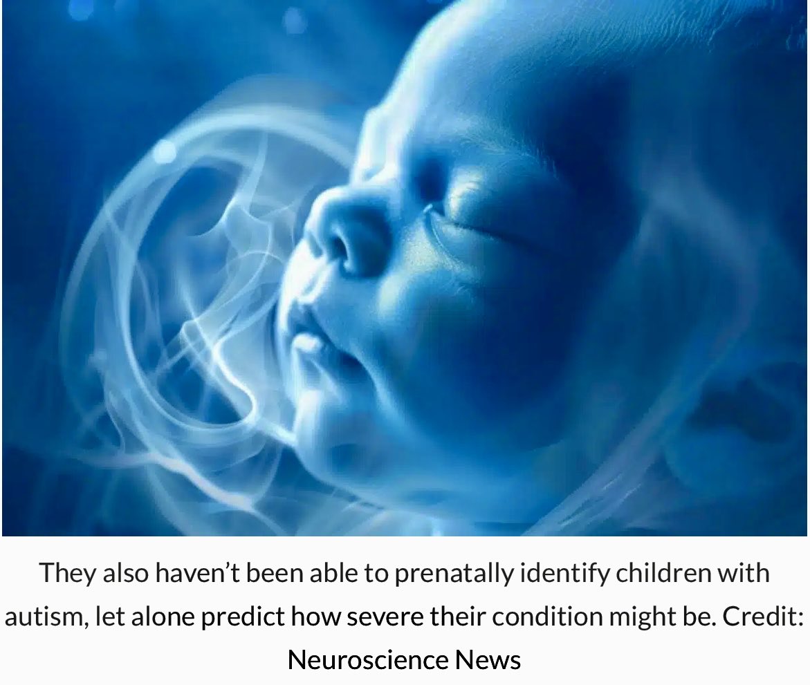 enilev's tweet photo. Autism Severity Linked to #Fetal #Brain Growth Patterns

Source: @UCSanDiego 

#Autism #ASD #prenatal #BCOs #Neuroscience 

👉https://t.co/IS3xIvWyZ5

All children with autism showed faster #brain #organoid #growth than neurotypical peers.

@Khulood_Almani @efipm @IanLJones98 @jeancayeux  @Shi4Tech @mvollmer1 @Nicochan33 @jblefevre60 @BetaMoroney @ipfconline1 @HaroldSinnott @FrRonconi @PawlowskiMario @gvalan @labordeolivier @bamitav @Fabriziobustama @SabineVdL @mikeflache 
@CurieuxExplorer @ahier @sonu_monika @pettet50 
@Eli_Krumova @RLDI_Lamy @AndrewinContact @AkwyZ @Analytics_699 @Timothy_Hughes @TanyaSinha_ @joana_ut @theomitsa @Hana_ElSayyed @Sharleneisenia @anand_narang   @Timothy_Hughes @AlbertoEMachado @KanezaDiane  @YuHelenYu @segundoatdell @baski_LA @GlenGilmore @JBarbosaPR  @HeinzVHoenen 
#seohashtag 
#Neurotech  #NeuroscienceNews