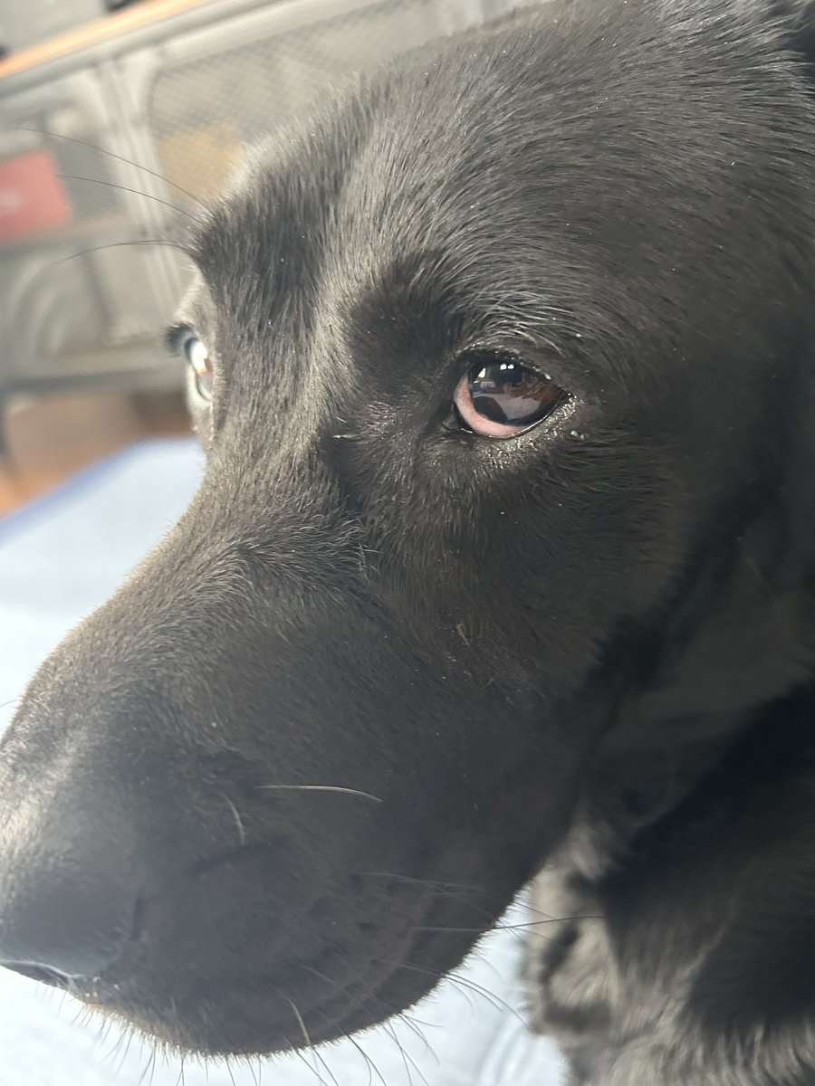 npotefu's tweet photo. めめが真っ赤になって目黄色いやにも酷かったから病院行った🥺点眼薬もらって5日目。白くなってきた！良かった！黄色く無いけど目やに出るからもうちょいって感じ！早く治るといいなぁぁぁぁ🥺🥺🥺 https://t.co/aVmxiEprAX