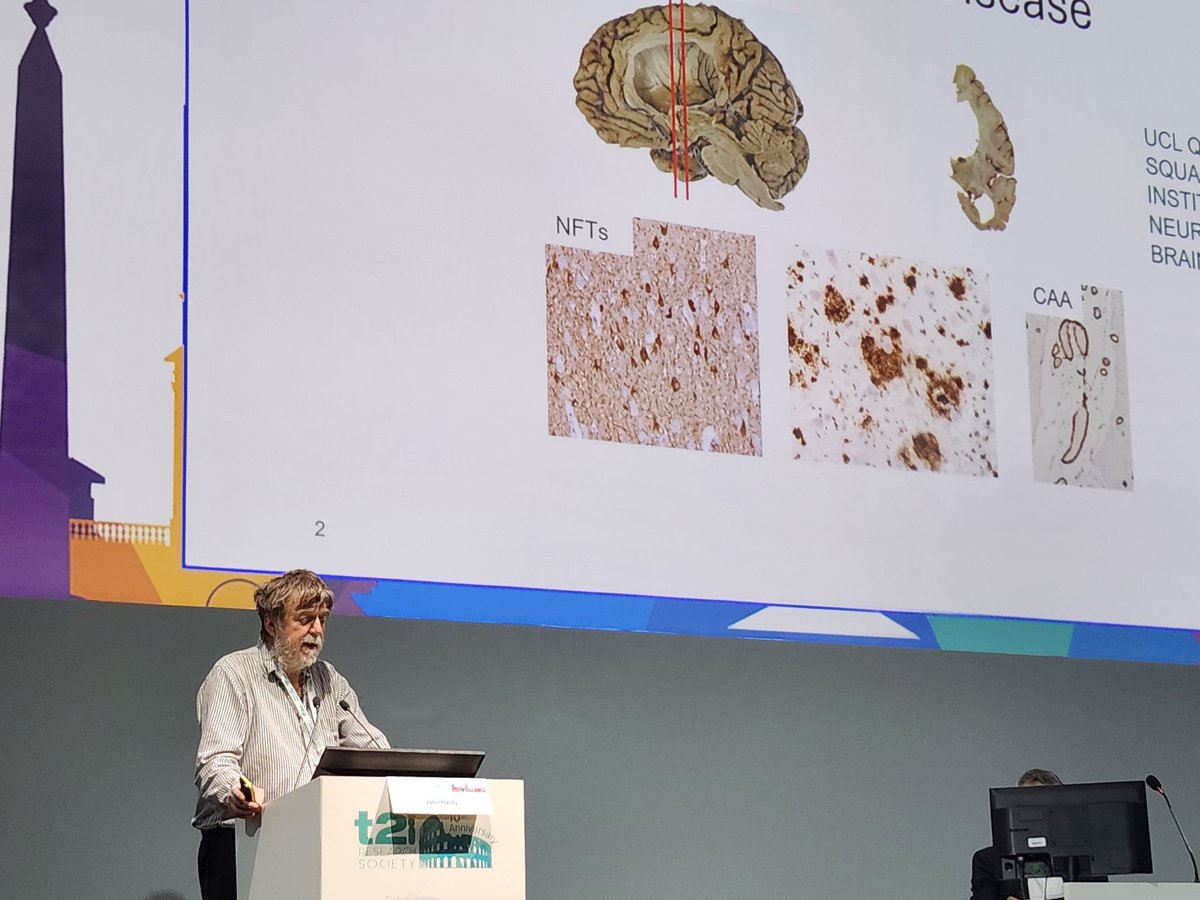 Did you know we learned a lot about amyloid in Alzheimer's disease from people with Down syndrome?? Dr. John Hardy gave a fun and compelling plenary today! #t21rs