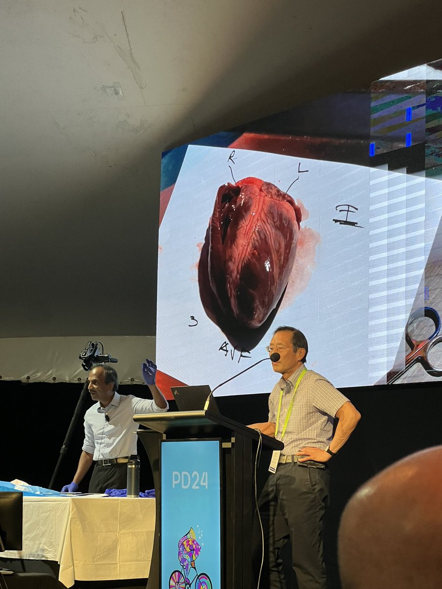 Rebecca Kozor (@rebeccakozor) on Twitter photo The BEST conference session. Drs Sam Asirvatham & Rick Nishimura demonstrating the correlation between ECG abnormalities & cardiac anatomy with live dissection 🫀Wow 🫀#PDHeart2024 <a href="/mugander/">Martin Ugander</a> <a href="/DrMarthaGulati/">Dr. Martha Gulati ♥️🫀❤️🩹🇨🇦</a> <a href="/clara_chow/">Clara Chow</a> <a href="/Dr_JYounger/">Dr John Younger</a> <a href="/PlayfordDavid/">David Playford</a> The BEST conference session. Drs Sam Asirvatham & Rick Nishimura demonstrating the correlation between ECG abnormalities & cardiac anatomy with live dissection 🫀Wow 🫀#PDHeart2024 <a href="/mugander/">Martin Ugander</a> <a href="/DrMarthaGulati/">Dr. Martha Gulati ♥️🫀❤️🩹🇨🇦</a> <a href="/clara_chow/">Clara Chow</a> <a href="/Dr_JYounger/">Dr John Younger</a> <a href="/PlayfordDavid/">David Playford</a>
