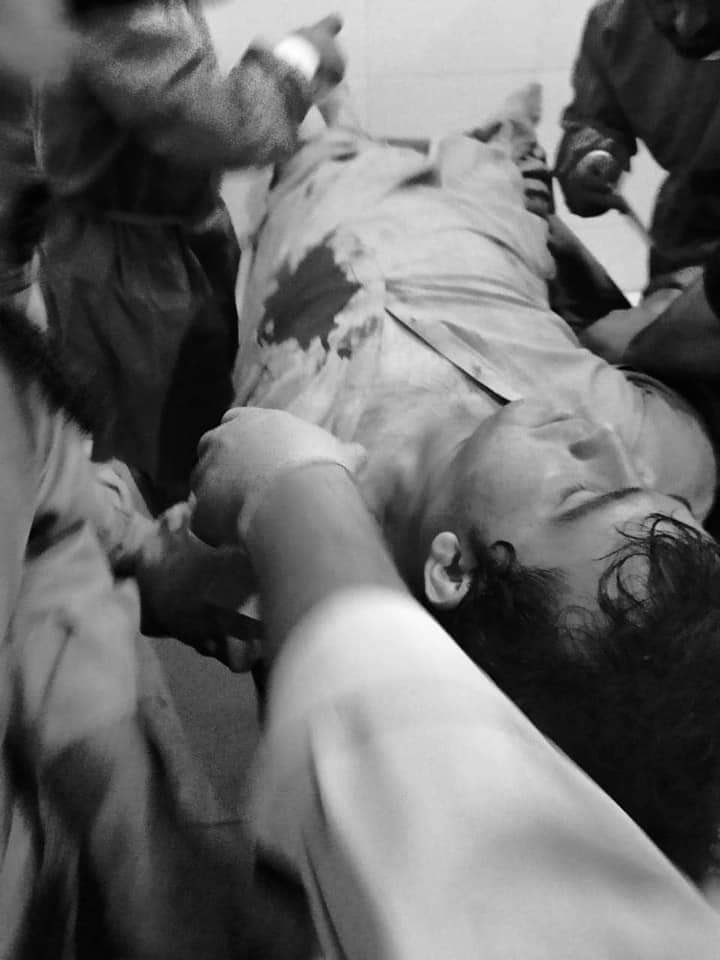 Akmal___Khan's tweet photo. دا جنګ ووس د چمن تر هري ګلي پوري راورسيدي
53 کسان ده fc لخوا اغوا شول 
36 زخميان
لا ووس هم قامي مشران په خپلو کي سره اخته دي

 #StandWithChamanSitIn https://t.co/jGcyP1s7aq