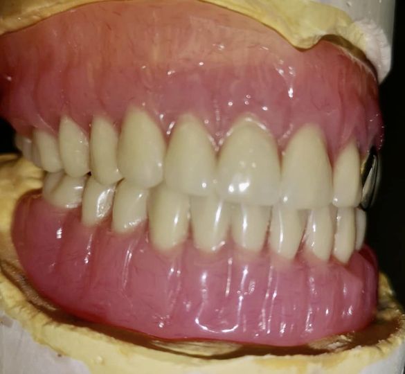Attenborough Dental offer Flexi denture, acrylic denture and 3D printing denture!
Attenborough Medical
#attenboroughmedical
#attenboroughdental