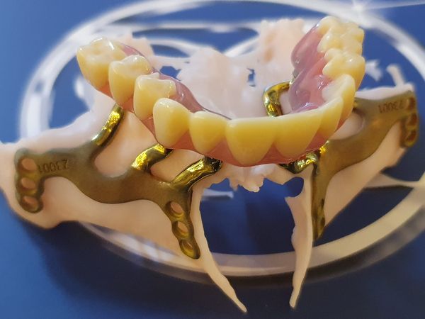 Subperiosteal patient specific implants and prosthesis on display today at OMFS Autumn meeting, Thor Central, Genk, Belgium omfs.be