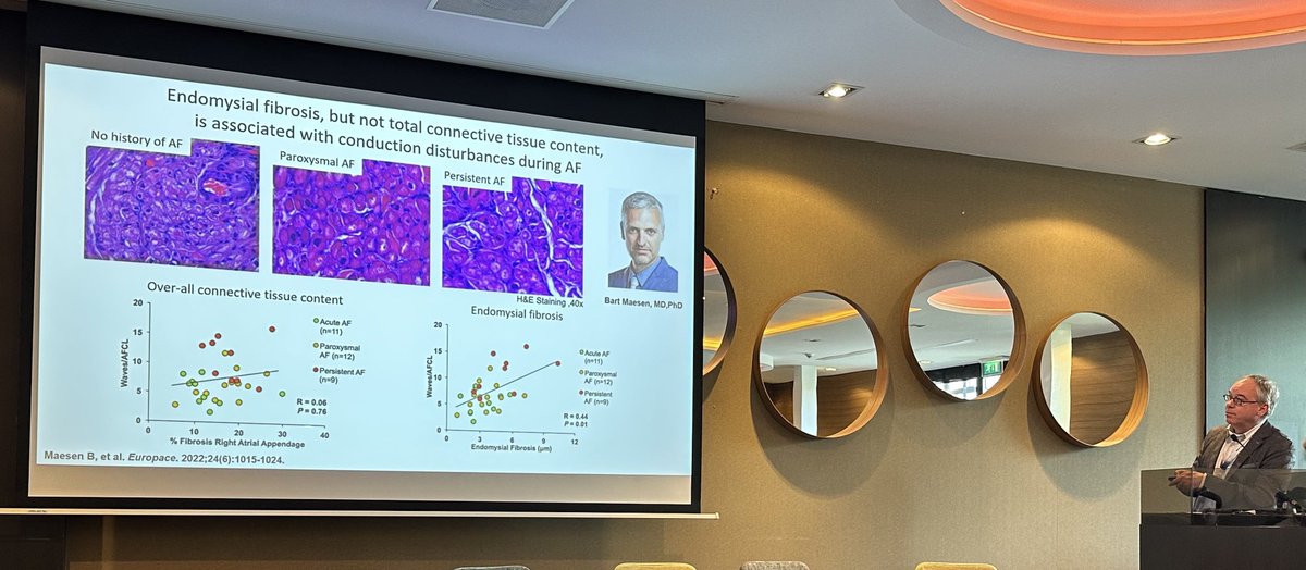 Sanjiv Narayan (@s_narayanmd) on Twitter photo Atrial #cardiomyopathy and #afib: related to specific endomysial fibrosis - not general connective tissue content. <a href="/UliSchotten/">Uli Schotten</a> @stefzeemering <a href="/axel_loewe/">Axel Loewe (axel-loewe.bsky.social)</a> <a href="/JordiHeijman/">Jordi Heijman</a> <a href="/nmarrouche/">Nassir Marrouche</a> <a href="/EPDeneke/">Thomas Deneke</a> <a href="/atulverma_md/">Atul Verma</a> #atrialsignals2024 Atrial #cardiomyopathy and #afib: related to specific endomysial fibrosis - not general connective tissue content. <a href="/UliSchotten/">Uli Schotten</a> @stefzeemering <a href="/axel_loewe/">Axel Loewe (axel-loewe.bsky.social)</a> <a href="/JordiHeijman/">Jordi Heijman</a> <a href="/nmarrouche/">Nassir Marrouche</a> <a href="/EPDeneke/">Thomas Deneke</a> <a href="/atulverma_md/">Atul Verma</a> #atrialsignals2024