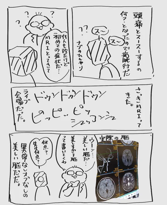 きょうのにっき。MRIの音は思想高めのロックでテクノだし、頭痛は寝たら治ったし、7000円の私の美しい脳のCDromが爆誕した 