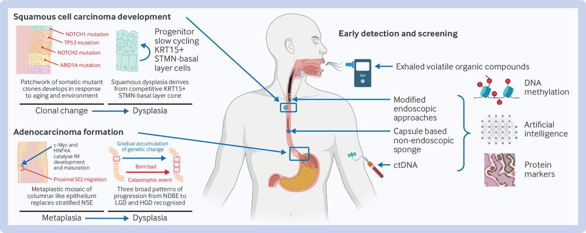 Bartomeu_Colom's tweet photo. "Advances in diagnosis and management of cancer of the esophagus"
https://t.co/dYGIDDRieH https://t.co/BgHQCOcxNn