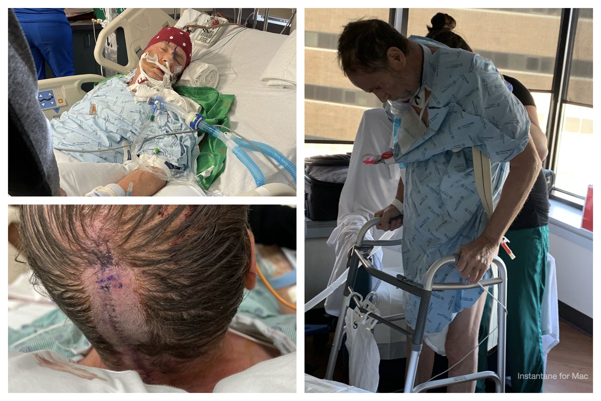 covidjabstroke's tweet photo. THIS COULD HAPPEN TO YOU! I tell my story to help others assess risks from the covid jab. It’s dangerous &amp; if you decide to assume those risks that should be your decision. People that threaten others with their job to comply with their bad decisions need to be held accountable! https://t.co/WQMqyLAjUq