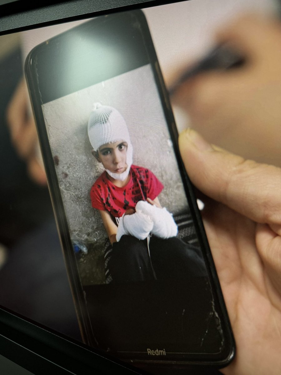 Isabel Schayani (@isabelschayani) on Twitter photo Das Bild geht mir nicht aus dem Kopf. #Idlib.Der Vater und der Zwillingsbruder kommen beim Angriff ums Leben.Der Junge überlebt.Die Mutter will ihr verletztes Kind in Sicherheit bringen.
Die Gründe für #Flucht sind auch Krieg. Ist 🇩🇪 am
Limit? Dazu die Doku nach d <a href="/tagesthemen/">tagesthemen</a> Das Bild geht mir nicht aus dem Kopf. #Idlib.Der Vater und der Zwillingsbruder kommen beim Angriff ums Leben.Der Junge überlebt.Die Mutter will ihr verletztes Kind in Sicherheit bringen.
Die Gründe für #Flucht sind auch Krieg. Ist 🇩🇪 am
Limit? Dazu die Doku nach d <a href="/tagesthemen/">tagesthemen</a>