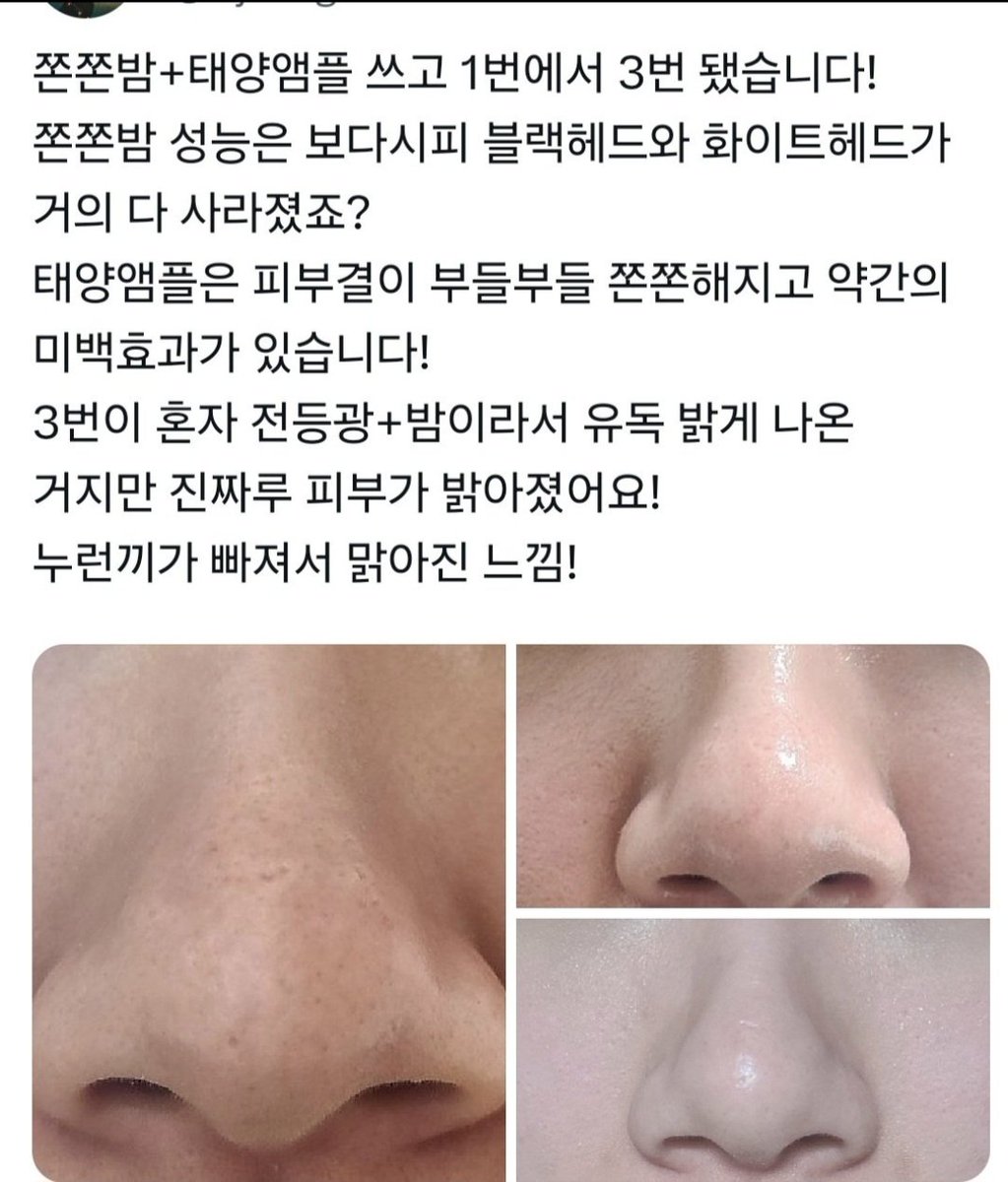피부호수가 실제로 내려가는 경험을
해보실 분을 찾습니다 😲
실제로 저는 21호->19호 되었는데요

태양앰플 써보실 분!_!
알티 하고 가시면 됩니다아
5분 드리겠습니다

피부도 좋아지는 마버업....
