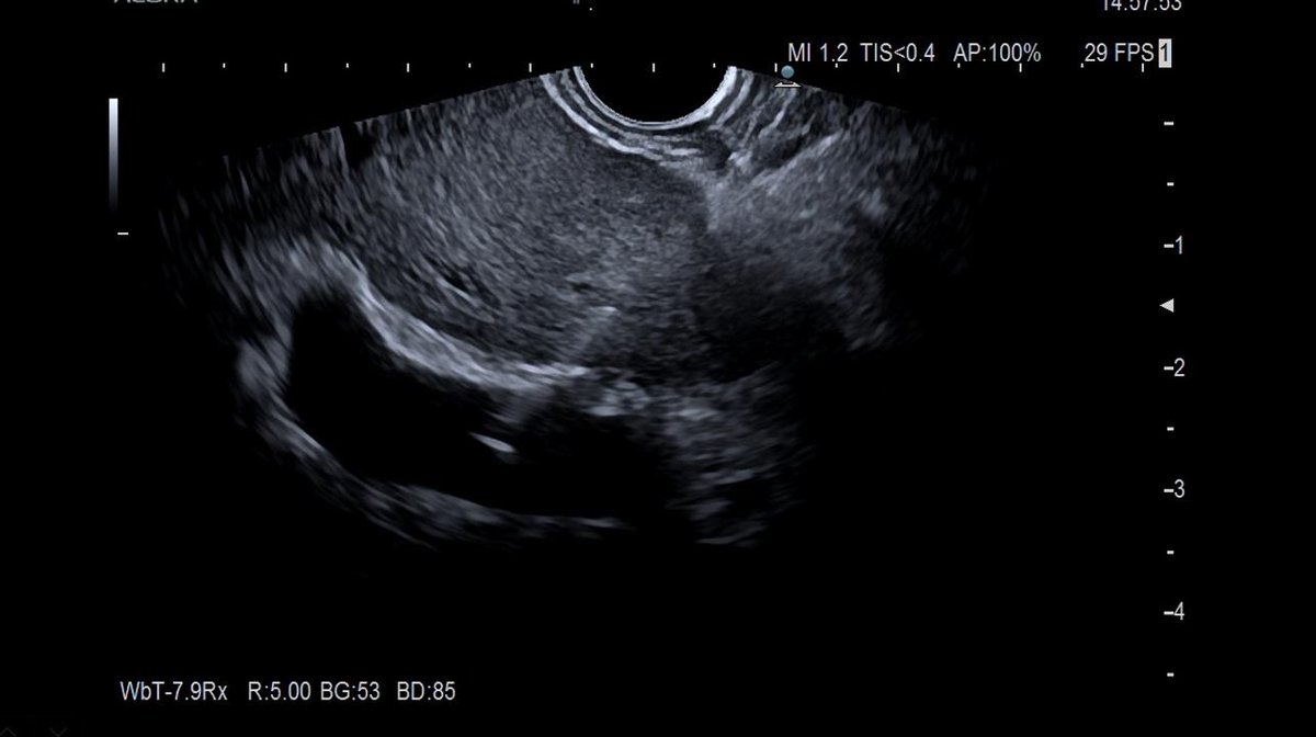 Digestivo Sierrallana tweet media