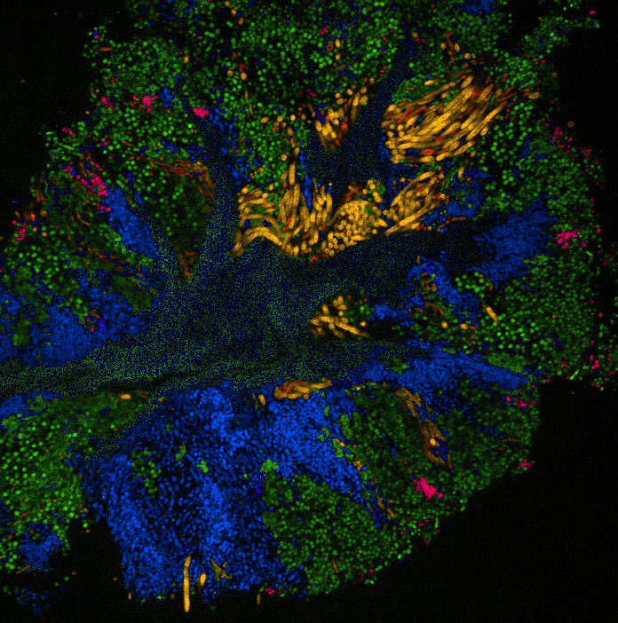 Tabita Ramirez (@microtabi) on Twitter photo Our paper <a href="/JDentRes/">Journal of Dental Research</a> on “Improved visualization of oral microbial consortia" is now published detailing our approach to improve image quality of bacteria on the tongue🔬😝 @JMarkWelch <a href="/ForsythResearch/">The ADA Forsyth Institute</a> #imaging #oralmicrobiome #oralbiofilm #oralmicrobiology
journals.sagepub.com/doi/10.1177/00… Our paper <a href="/JDentRes/">Journal of Dental Research</a> on “Improved visualization of oral microbial consortia" is now published detailing our approach to improve image quality of bacteria on the tongue🔬😝 @JMarkWelch <a href="/ForsythResearch/">The ADA Forsyth Institute</a> #imaging #oralmicrobiome #oralbiofilm #oralmicrobiology
journals.sagepub.com/doi/10.1177/00…