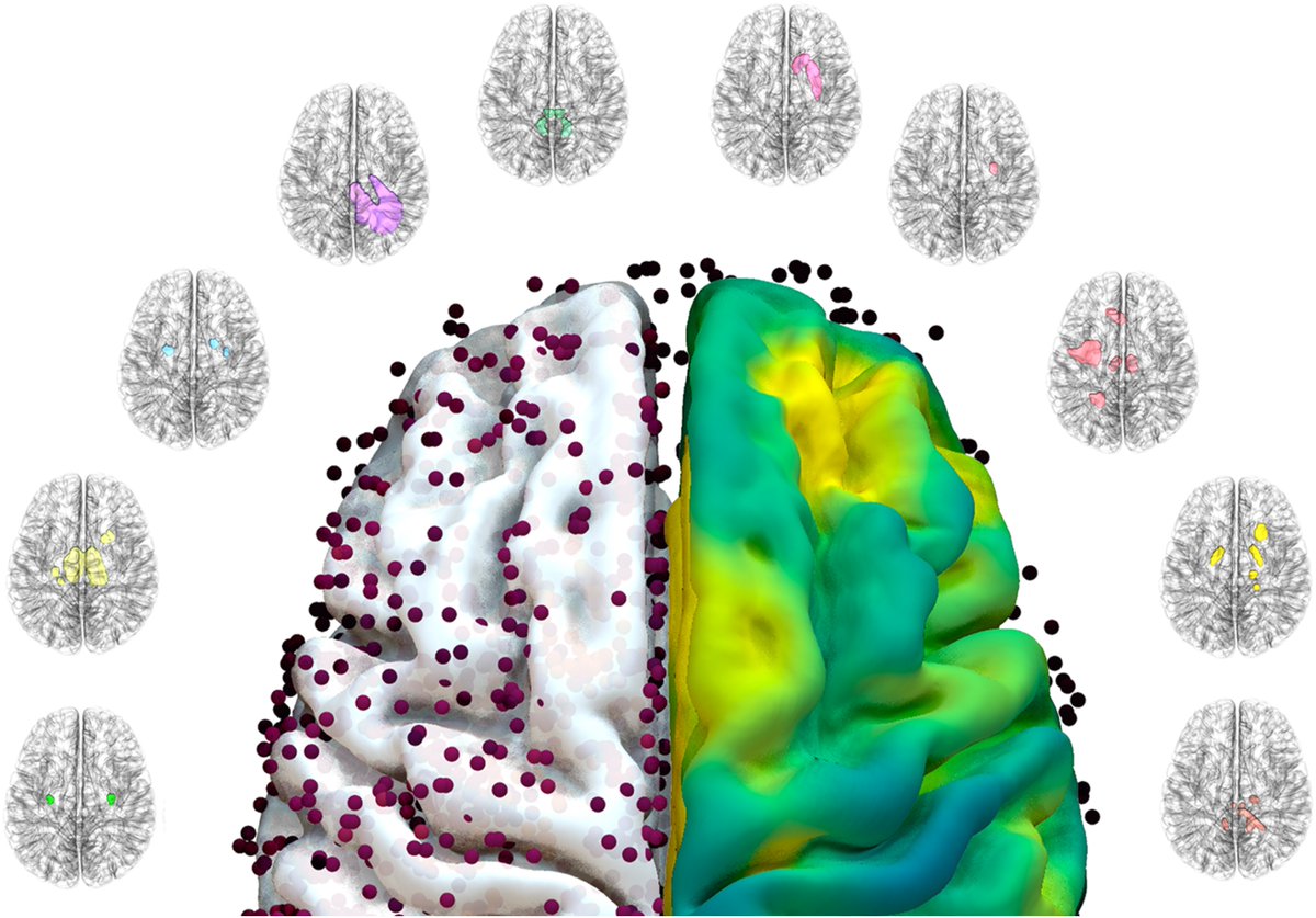 Al-Fatly et al. use lesion-network mapping to identify a network of brain regions involved in the pathophysiology of lesion-induced oculogyric crises, and show that the topography of the network overlaps with the expression of dopamine receptor type 2. tinyurl.com/5d4xek56
