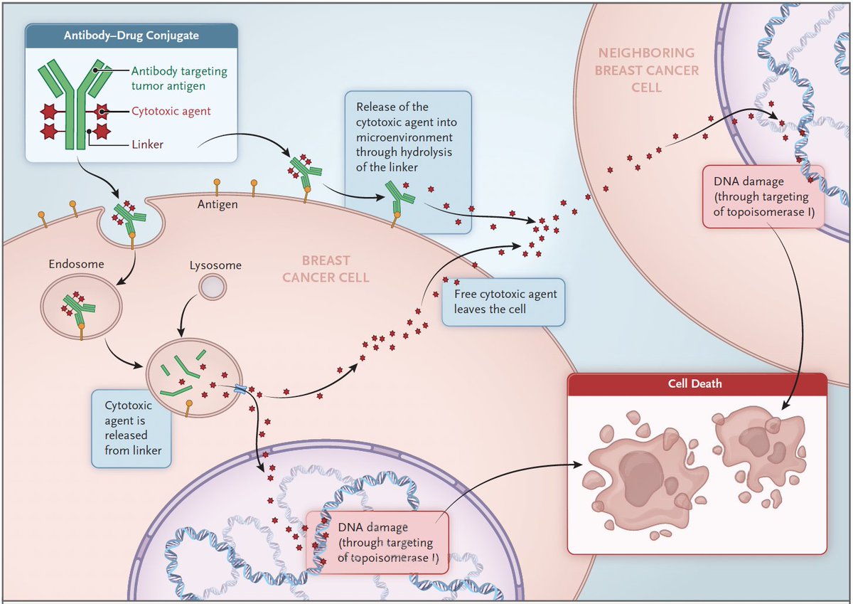 MGH Breast Oncology (@mghbreastonc) on Twitter photo In this <a href="/NEJM/">NEJM</a> CPC, Dr. Neelima Vidula <a href="/MGHBreastOnc/">MGH Breast Oncology</a> and colleagues <a href="/MGHCancerCenter/">Mass General Cancer Center</a> discuss their management of a patient with TNBC metastatic to their brain and lung using sequential ADCs as well as the potential benefits and challenges of ADC use: nejm.org/doi/full/10.10… In this <a href="/NEJM/">NEJM</a> CPC, Dr. Neelima Vidula <a href="/MGHBreastOnc/">MGH Breast Oncology</a> and colleagues <a href="/MGHCancerCenter/">Mass General Cancer Center</a> discuss their management of a patient with TNBC metastatic to their brain and lung using sequential ADCs as well as the potential benefits and challenges of ADC use: nejm.org/doi/full/10.10…
