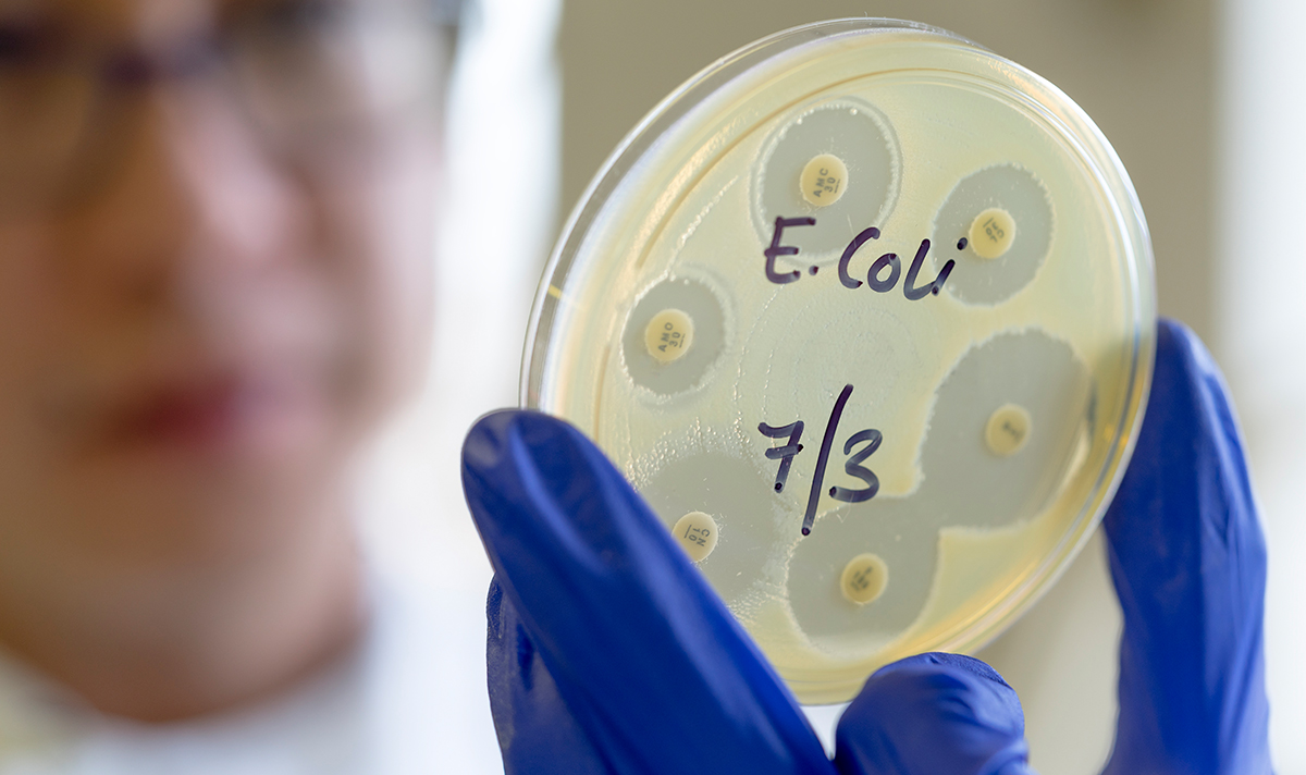 UK hit by outbreak of infection that causes ‘severe bloody diarrhoea’ and hospitalisations

express.co.uk/life-style/hea…
